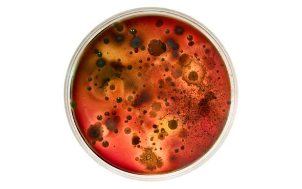 Bakterieskål